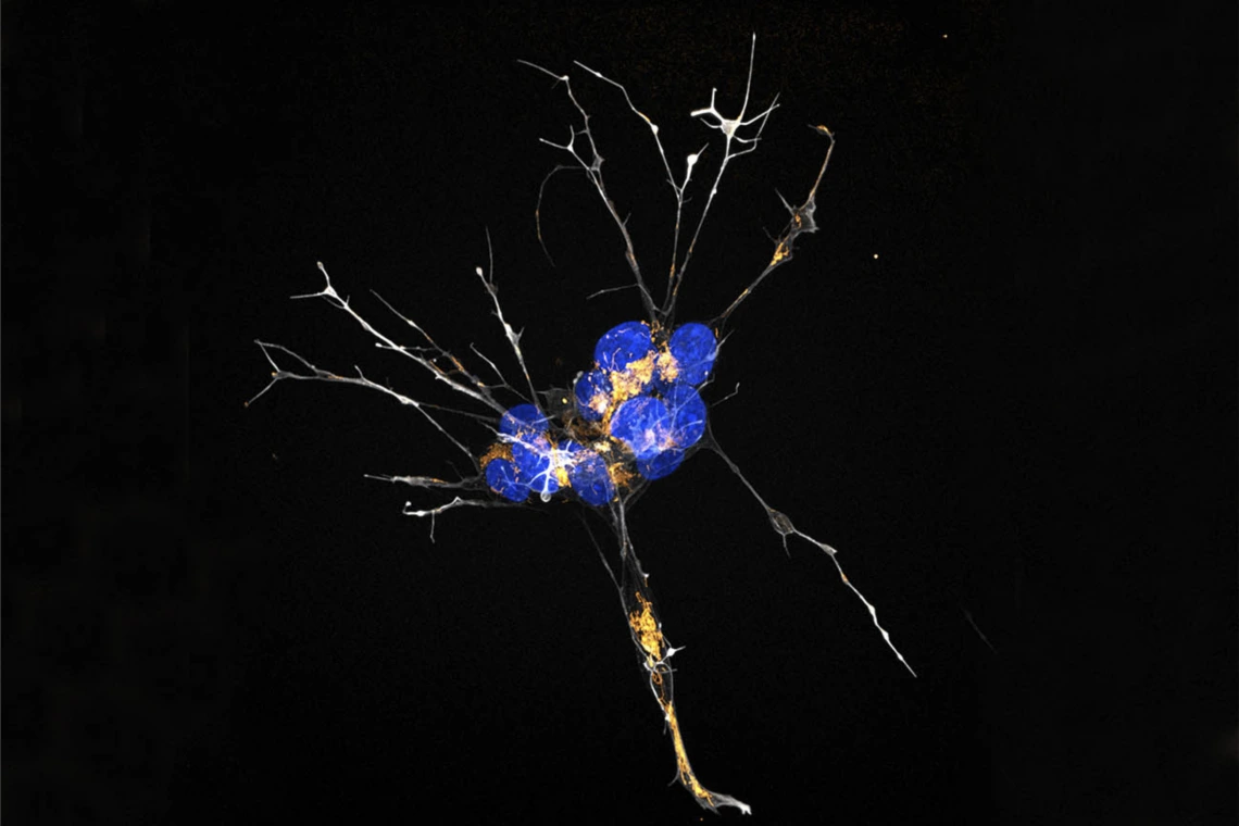 Close up of brain cell